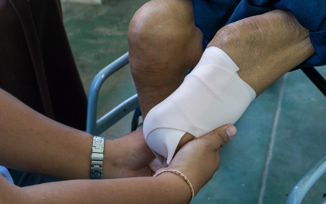 How to prevent a wound infection