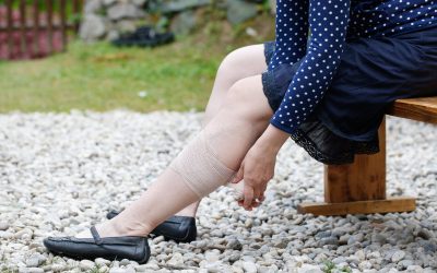 Medical Compression Stockings and Summer
