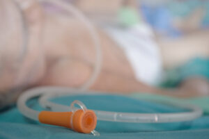 PEG feeding tube on hospital background PEG feeding tube