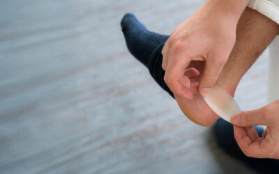 Preventing and treating blisters from physical activity