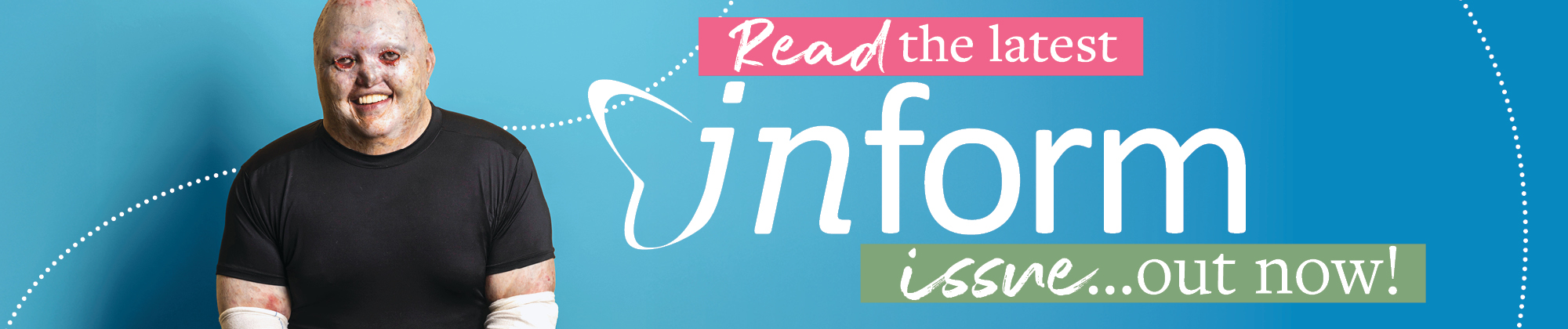 Inform Read Now
