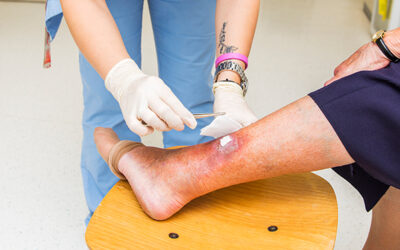 How to Identify and Treat an Infected Wound