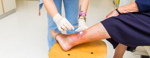 Getting Infected How to Identify and Treat an Infected Wound | Independence Australia