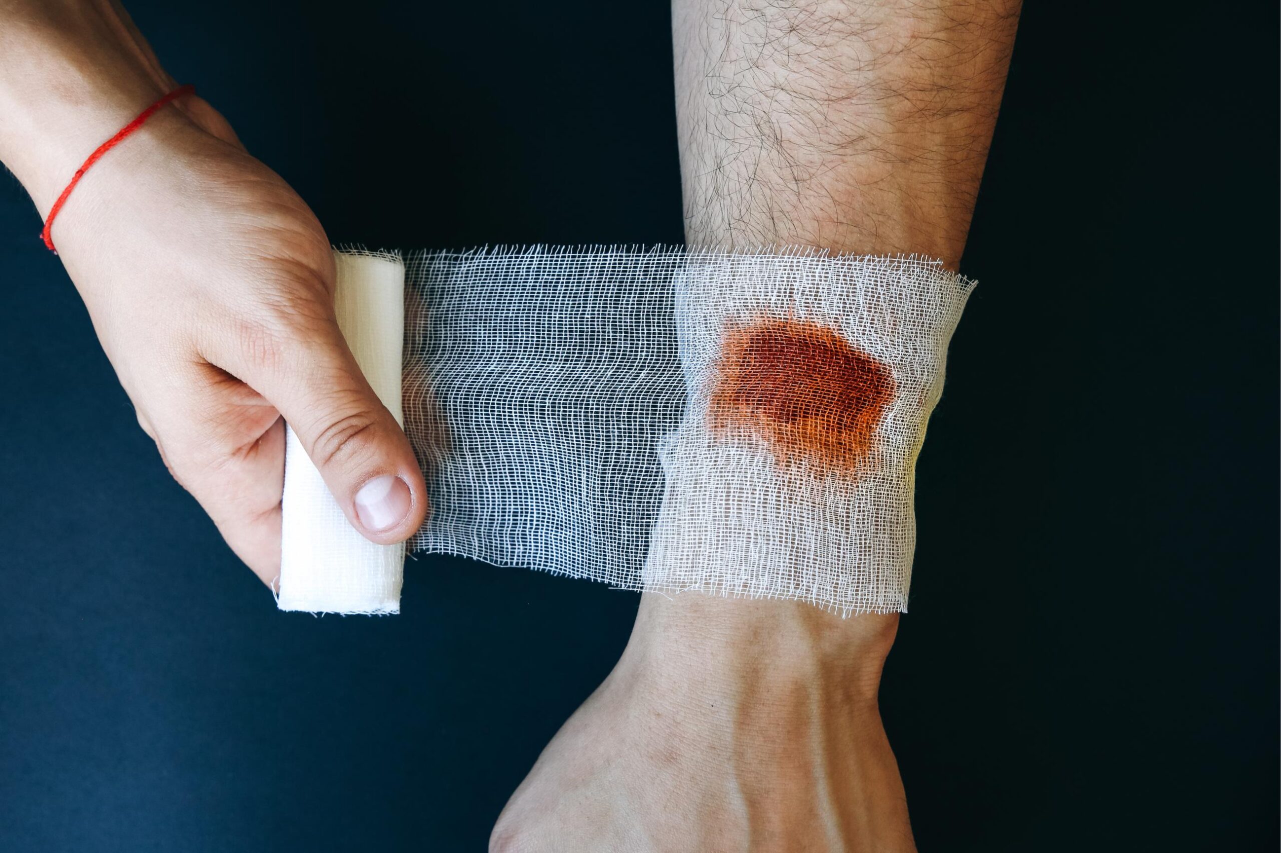 How to Treat and Prevent Scarring